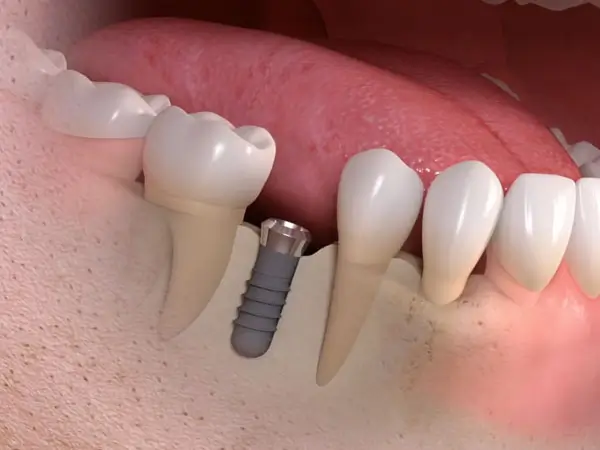 Recommended dental services in Thailand