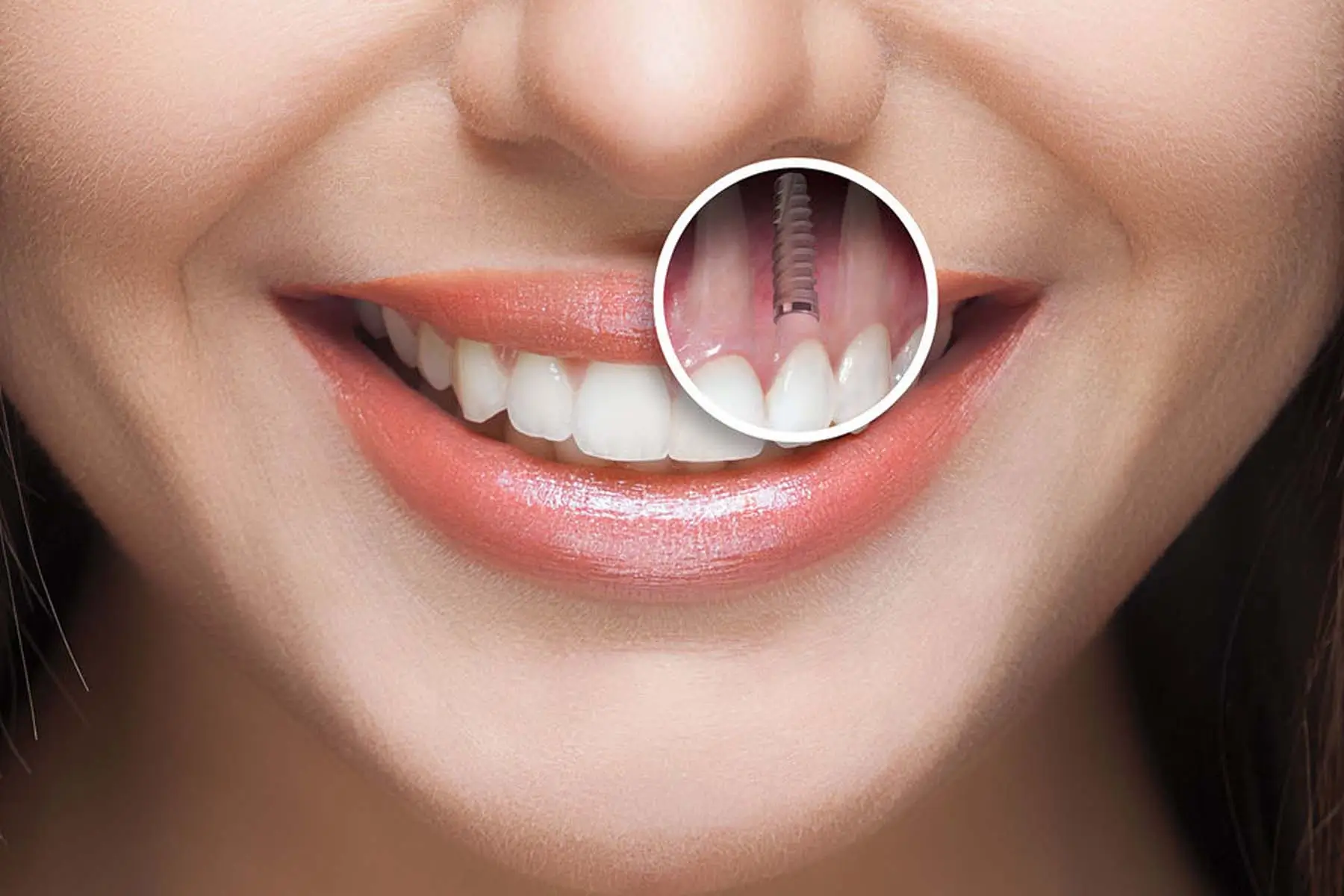 Recommended dental services in Thailand