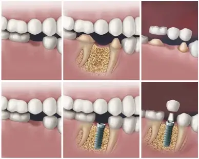 Recommended dental services in Thailand