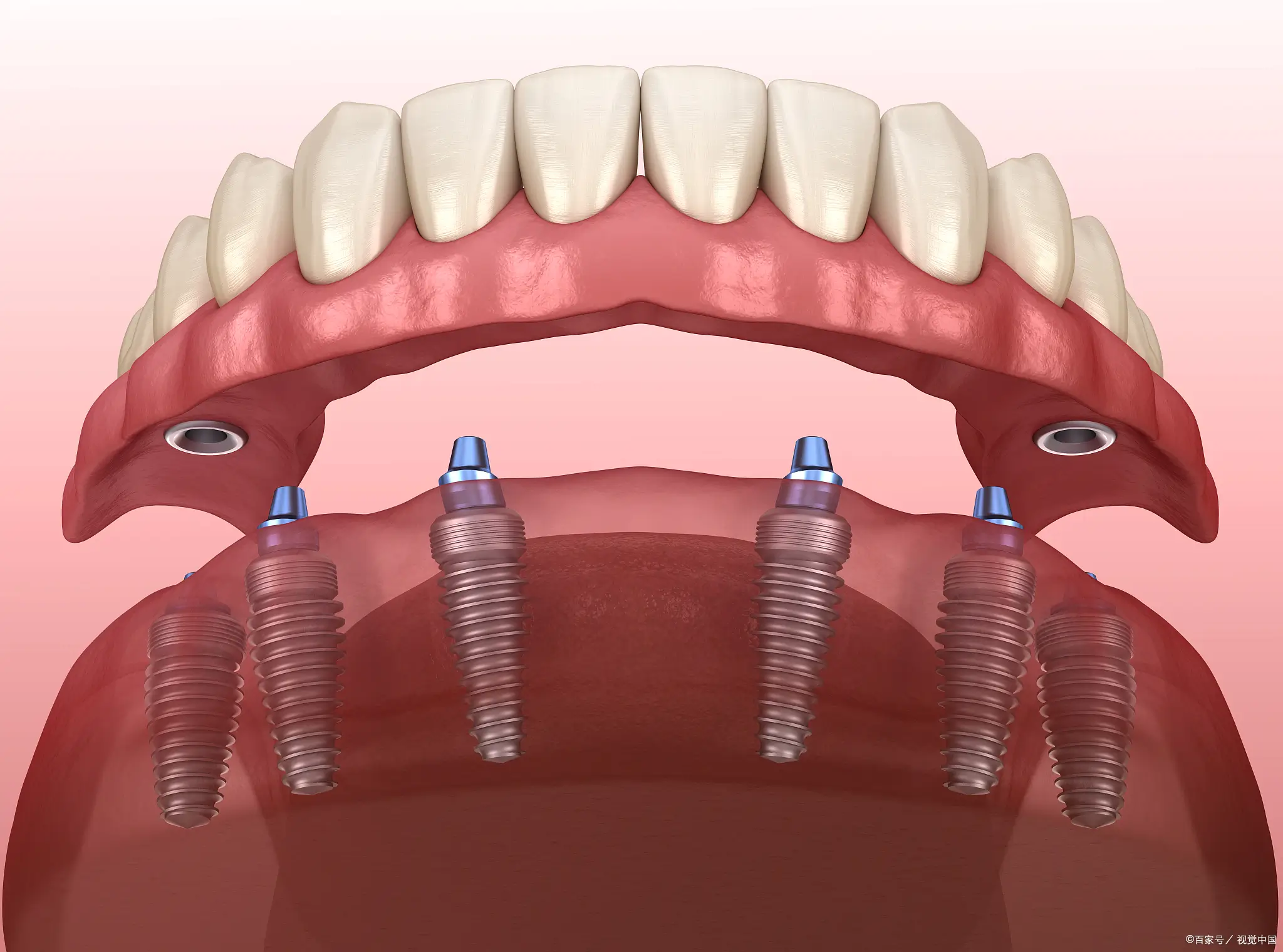 Recommended dental services in Thailand