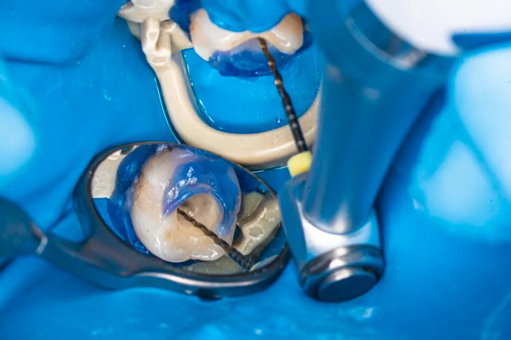 Thailand Root Canal for Swollen Face Cases