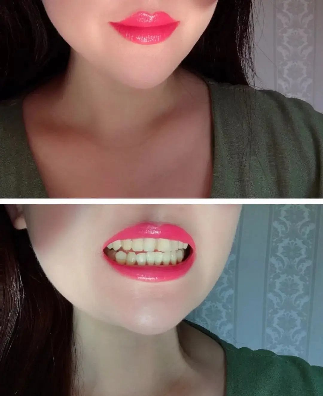 Bangkok Dental Hygiene Package – Real Local Price Breakdown