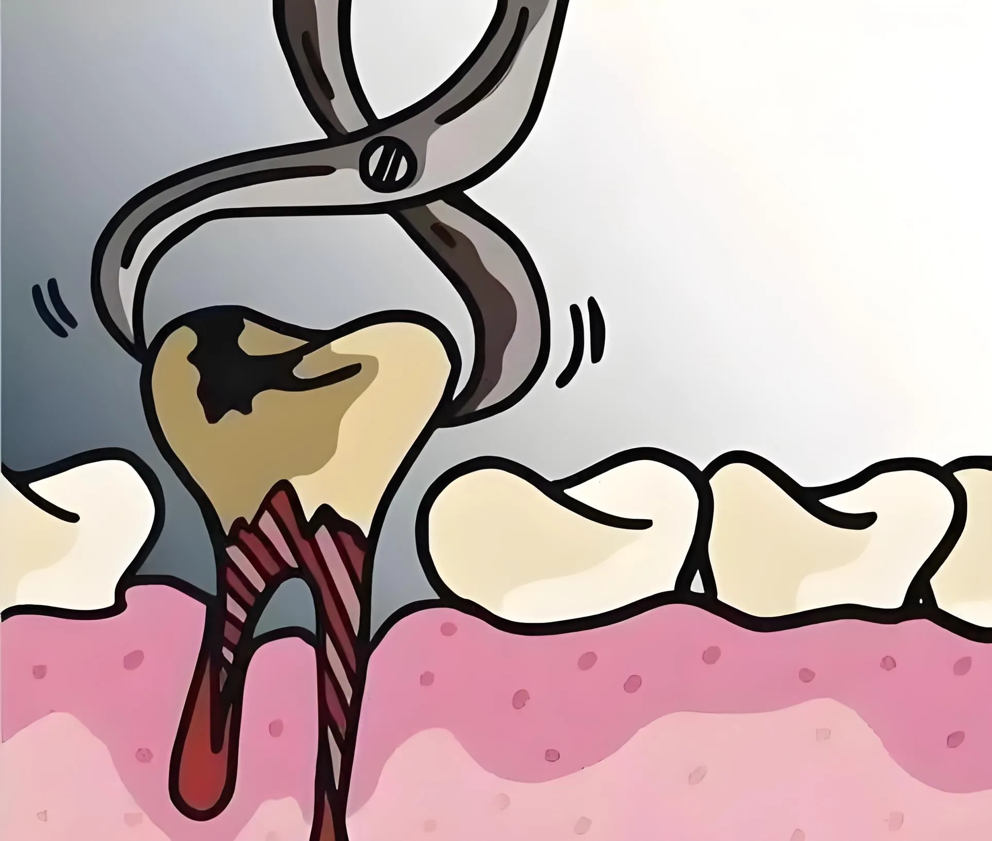 Thailand Tooth Extraction Clinics Offering Comprehensive Dental Care