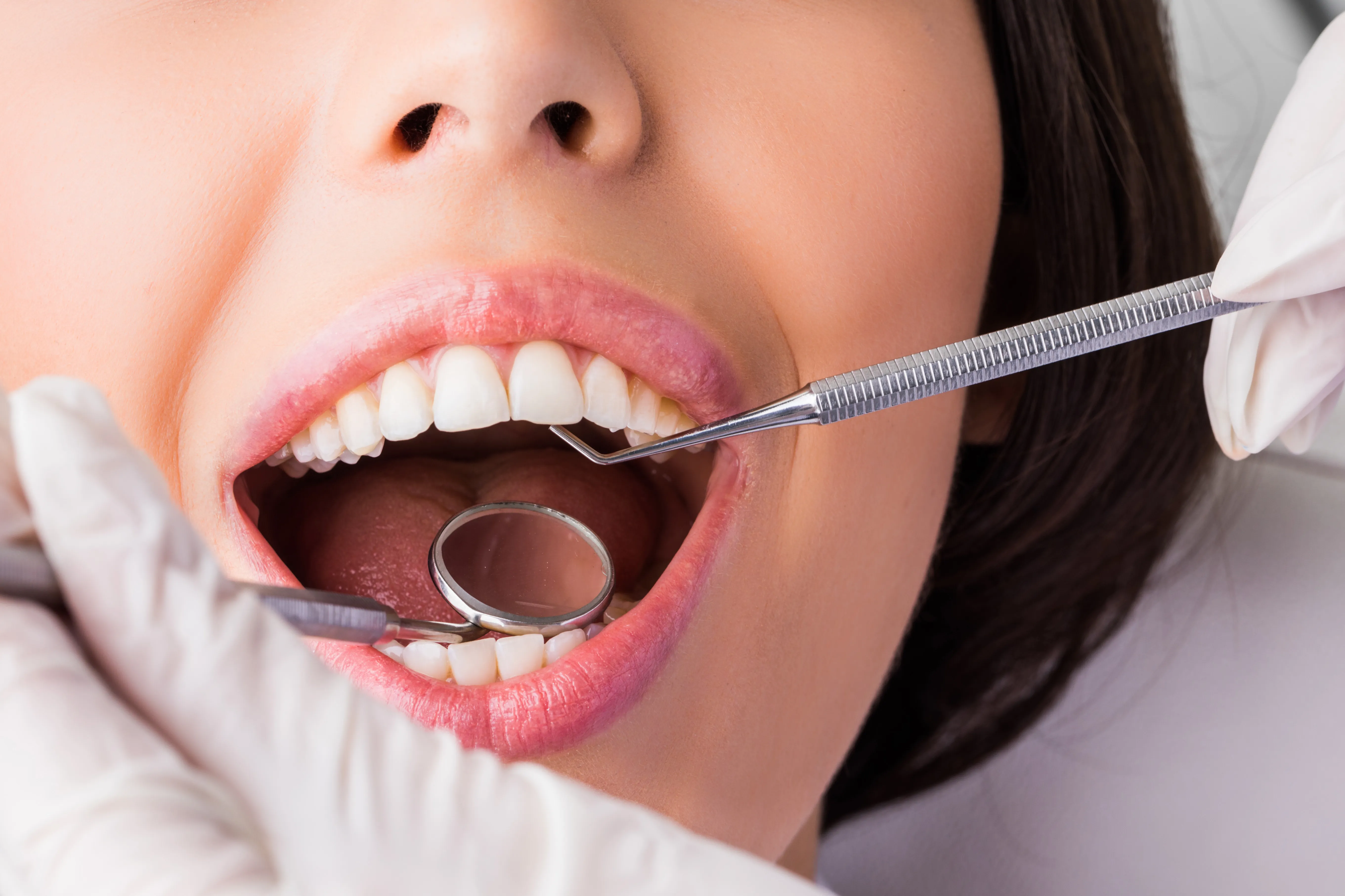 Thailand Tooth Extraction Clinics Offering Professional Dental Experience