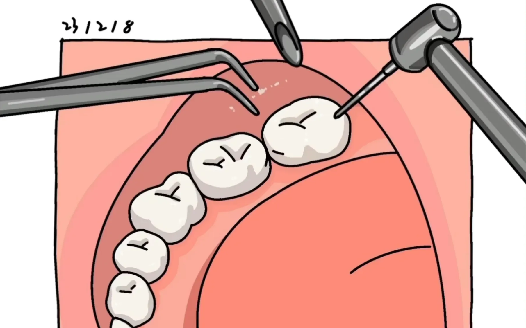 Thailand Tooth Extraction Services Supporting Safe and Comfortable Recovery