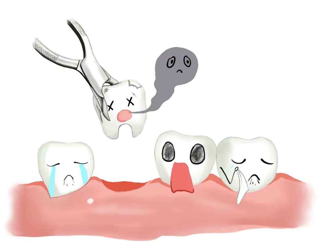 Thailand Tooth Extraction for Removing Teeth With Severe Damage