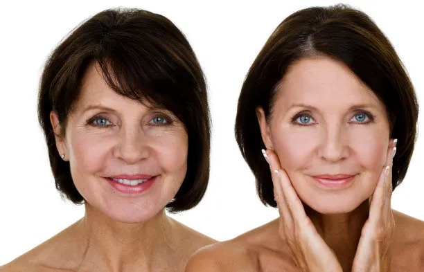 Beauty Beyond Borders: Exploring Cosmetic Surgery Tourism