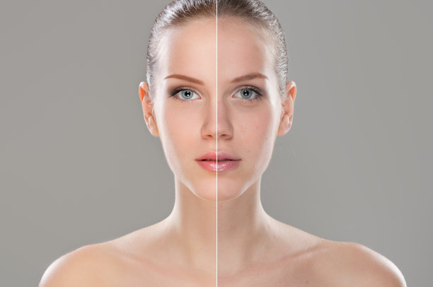 Unveiling the Global Trend: Traveling for Cosmetic Enhancements