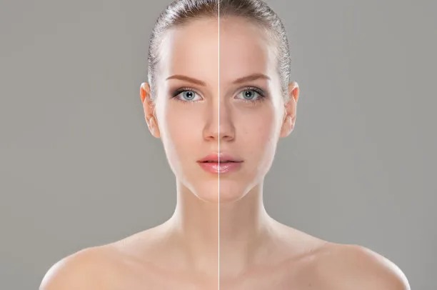Enhancing Beauty Abroad: The Rise of Travel for Cosmetic Procedures
