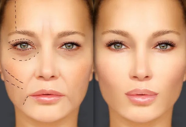Jet-Set for Beauty: The Rise of Travel for Cosmetic Surgery