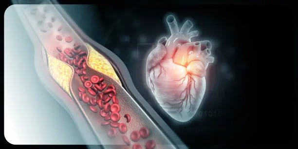 Advancements in Cross Border Solutions for Cardiovascular Disease Treatment