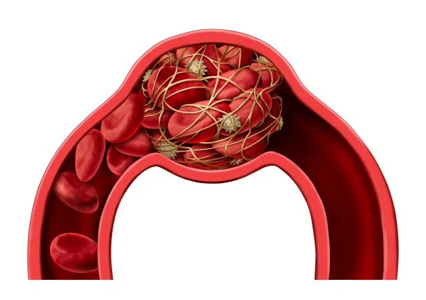 Advancements in Global Cardiovascular Disease Treatment Approaches
