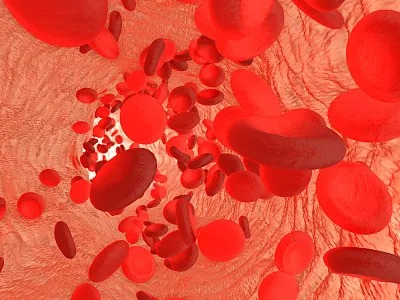 Advancements in Global Cardiovascular Disease Treatment Efforts