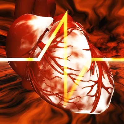 Innovative Approaches to Treating Cardiovascular Disease Across Borders