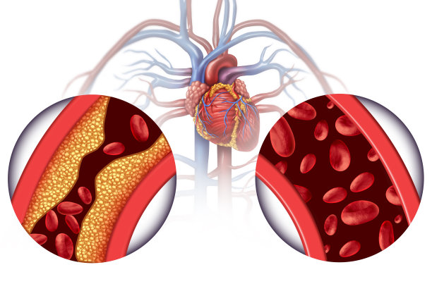 Innovative Approaches to Treating Cross-Border Cardiovascular Disease