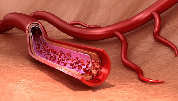 International Collaboration in Cardiovascular Disease Treatment: Breaking Borders and Saving Lives