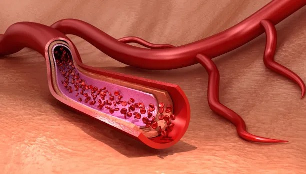 Advancements in International Cardiac Care: Treating Cardiovascular Disease Across Borders