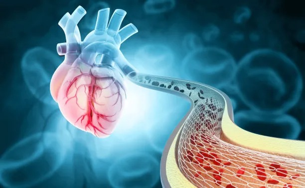 Advancements in International Cardiovascular Disease Therapy