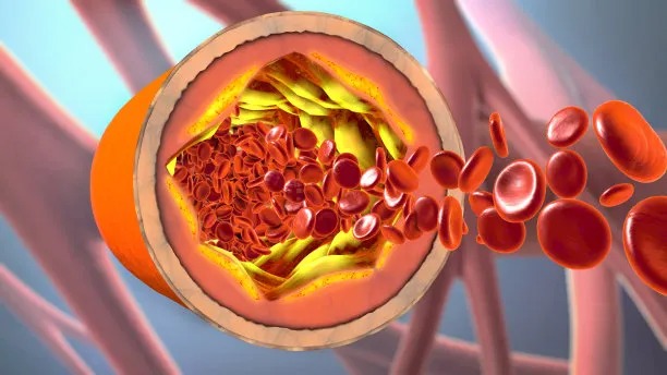 Advancements in International Treatment of Cardiovascular Diseases