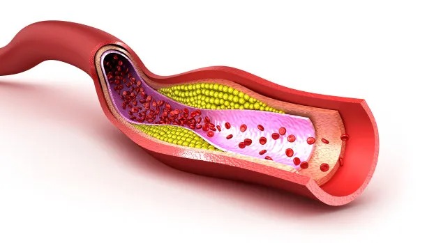 Enhancing Access to Cross-Border Cardiovascular Disease Treatment