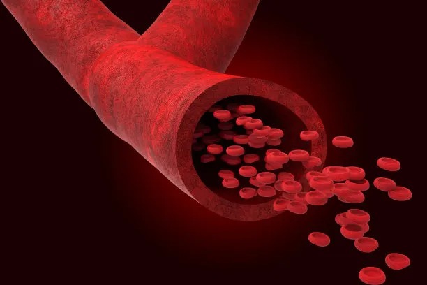 Enhancing Patient Care: Innovations in Cross-Border Cardiovascular Treatment