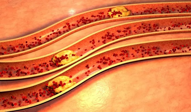 Global Advancements in Cardiovascular Disease Treatment Strategies