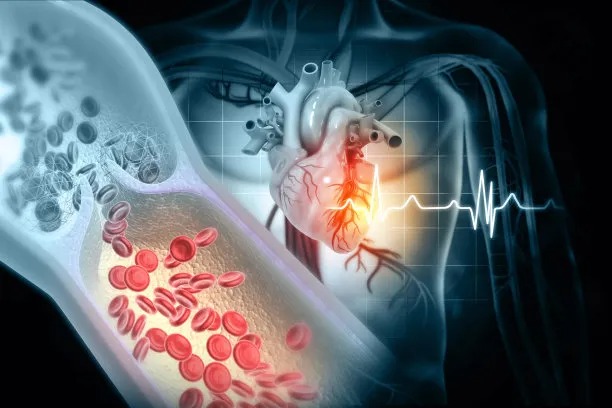 Innovations in International Cardiovascular Disease Care