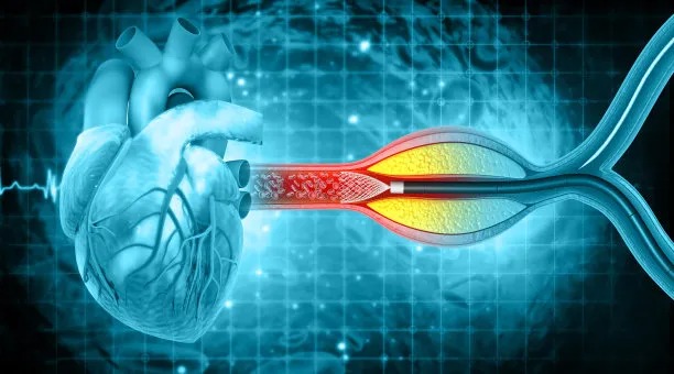 Innovative Approach to Cross-Border Cardiovascular Care