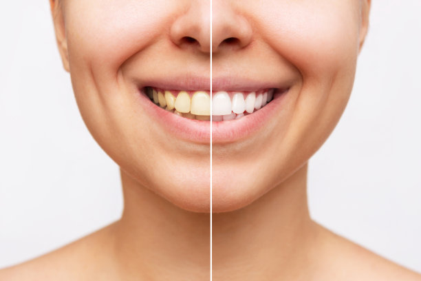 Discover the Benefits of Vietnam Dental Travel for Affordable and High-Quality Dental Care Solutions