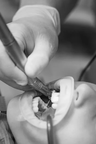 Discover Affordable Dental Implant Options in Vietnam and Enhance Your Smile While Exploring a Beautiful Country
