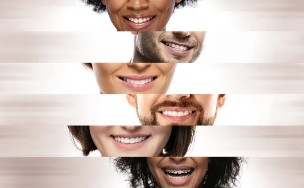 Enhance Your Smile: Discover the Benefits of Dental Implants in Vietnam for a Brighter Future