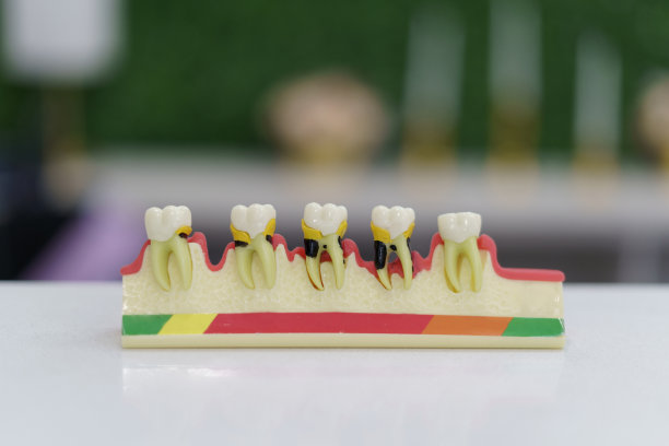 Discovering Stunning Smiles and Affordable Dentistry with Vietnam Dental Travel for a Perfect Healthcare Experience