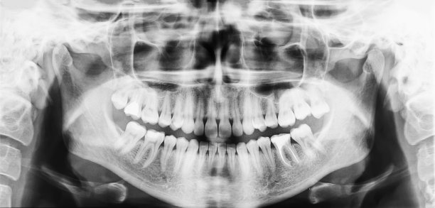 Discover Affordable Dental Solutions in Vietnam Transforming Your Smile with Quality Care and Travel Experience