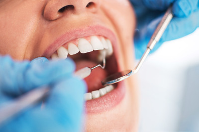 Discover Affordable Dental Solutions in Vietnam and Transform Your Smile with Exceptional Care and Expertise