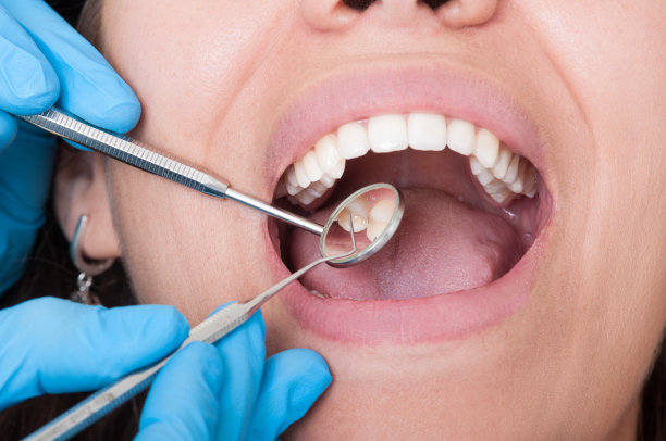 Top Countries Offering Exceptional Dental Care and Treatments for Common Oral Health Issues