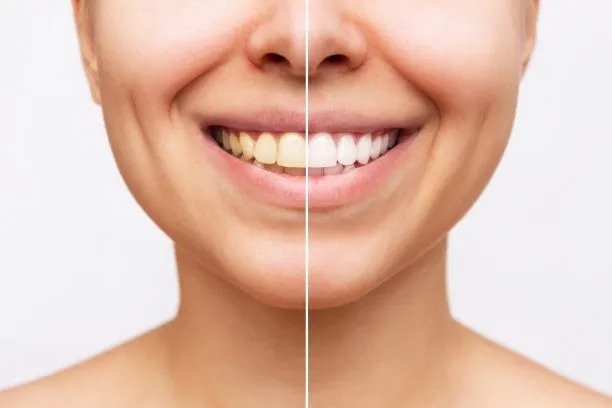Countries with Superior Dental Treatment: A Comprehensive Analysis