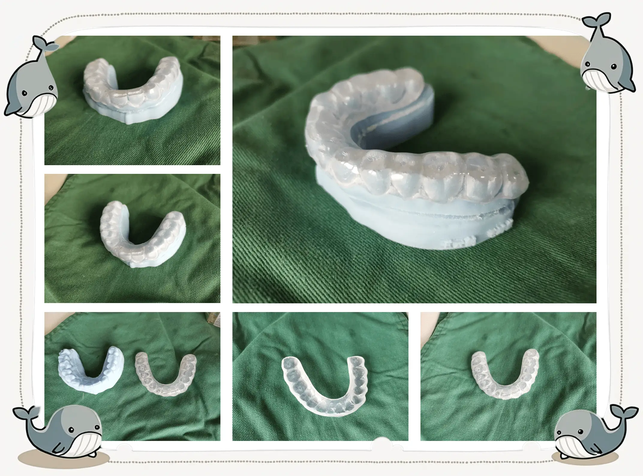 Do Night Guards Really Work? Understanding Their Role in Protecting Your Teeth