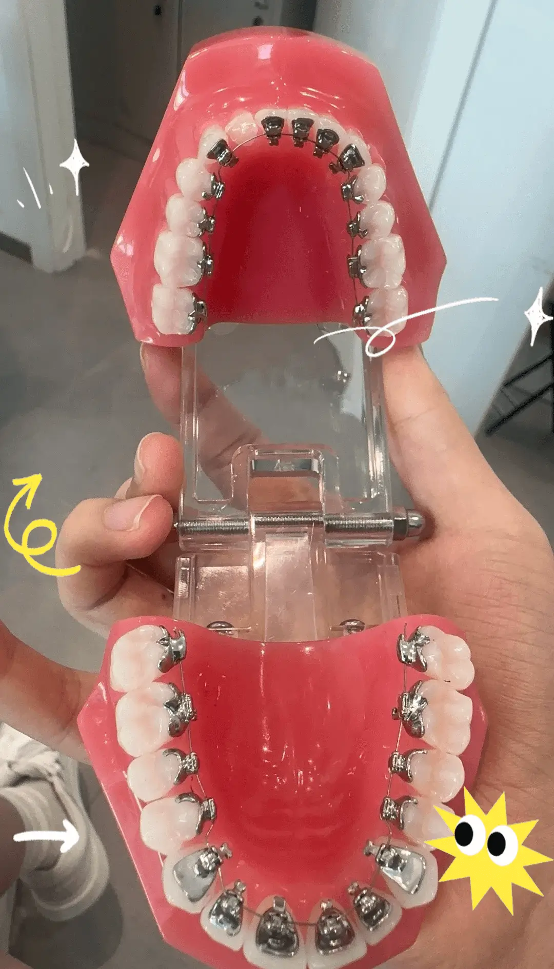 Lingual Orthodontics: The Invisible Solution Behind Your Smile