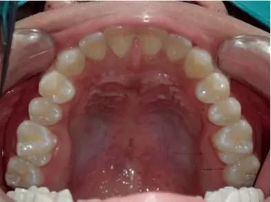 After Treatment