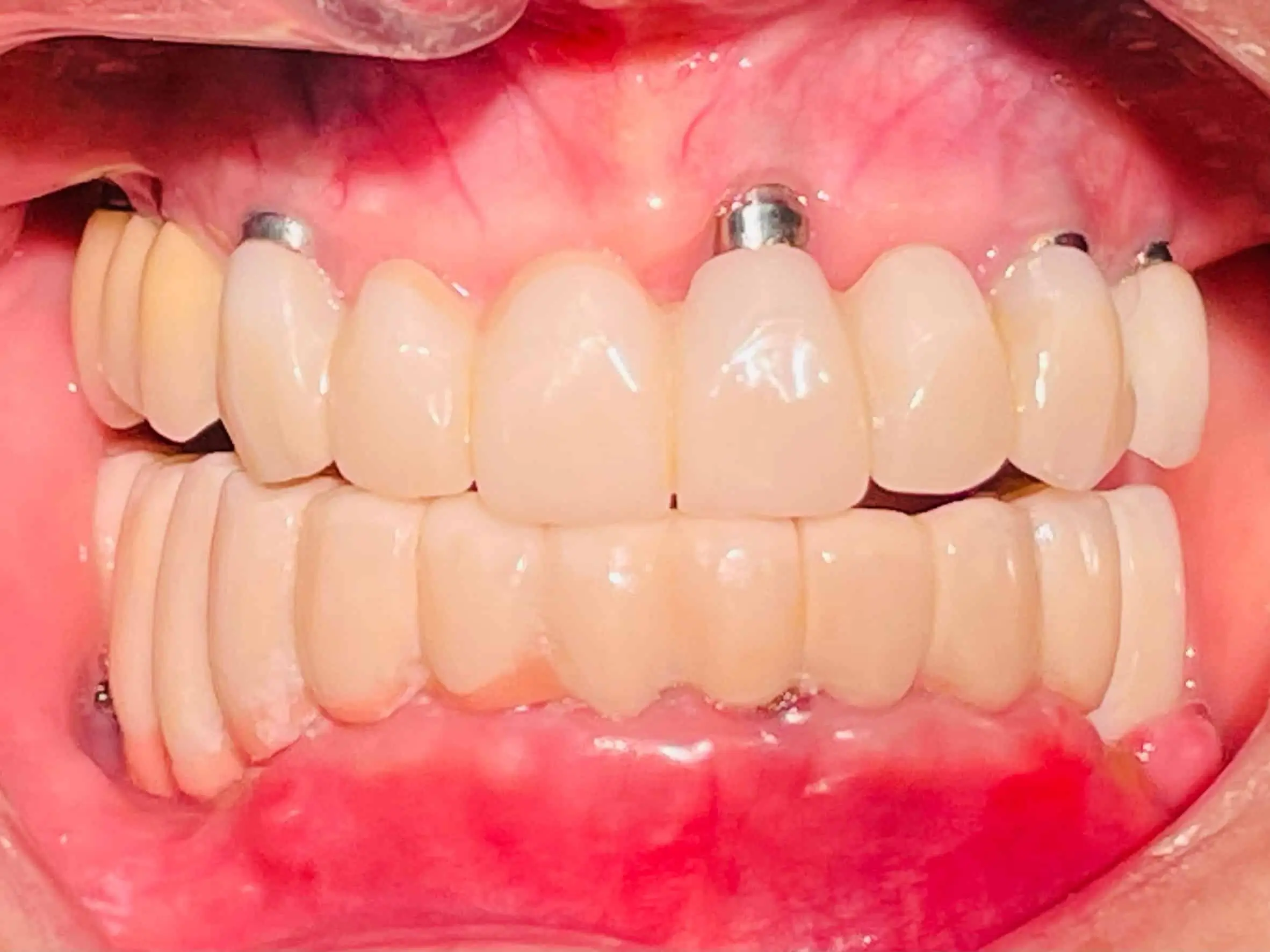 After Treatment