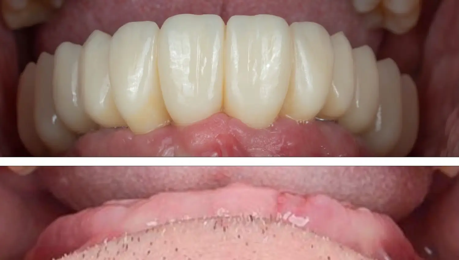 After Treatment