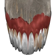 Bespoke Smile Makeover