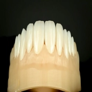 Bespoke Smile Makeover