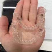 Invisalign Orthodontic Treatment: A Modern Path to a Straighter Smile