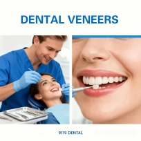 Dental Veneers – Advanced Cosmetic Solution for a Brighter, Perfect Smile