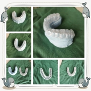 Do Night Guards Really Work? Understanding Their Role in Protecting Your Teeth